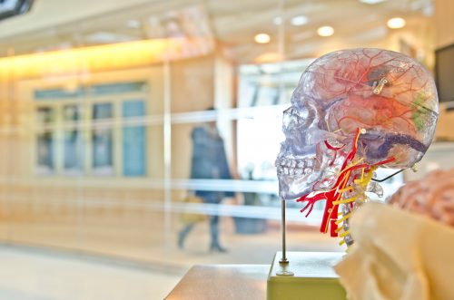 Model skull depicting brain injury